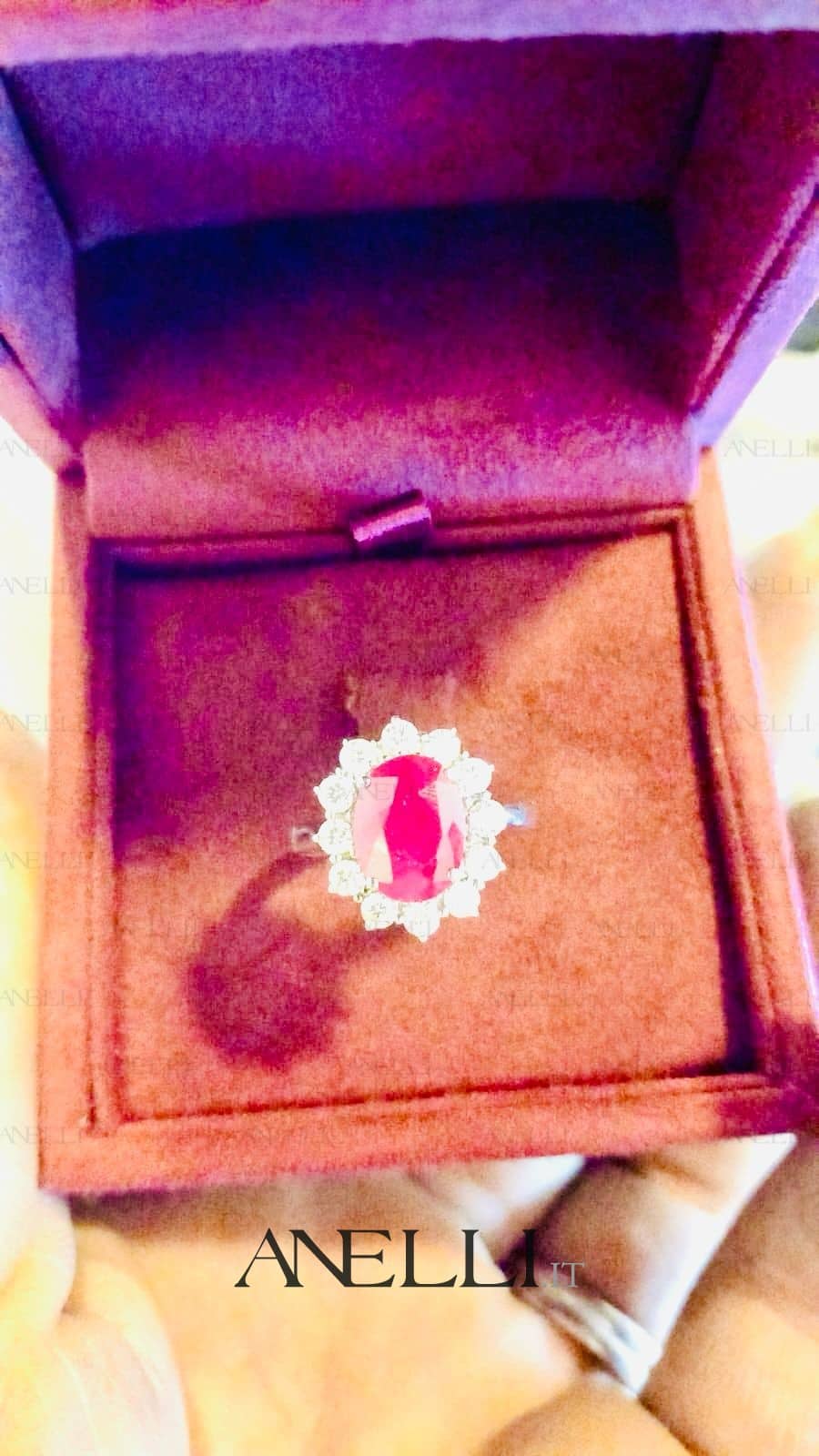 Anello-Rubino-Rosa-Birmano-2